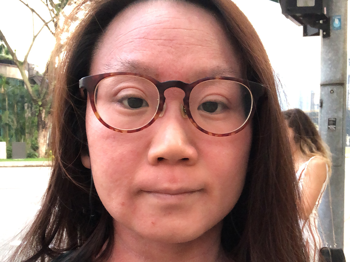 I have Red Skin Syndrome, but I have not given up hope