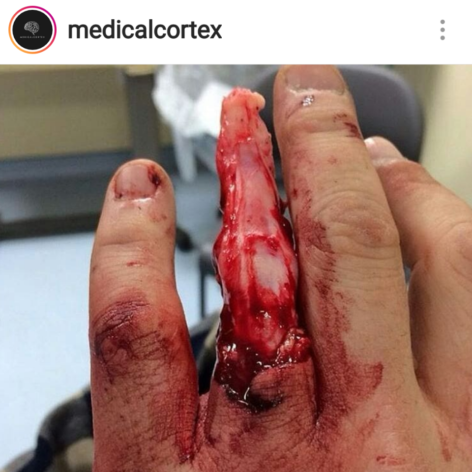 gruesome pictures alert jovisjoey dayre