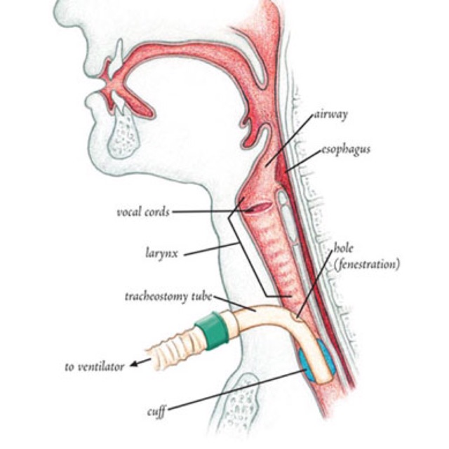 Tube In The Throat 59