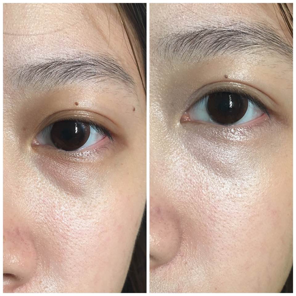 Review: Becca Under Eye Brightening Corrector - Hermioneginny - Dayre