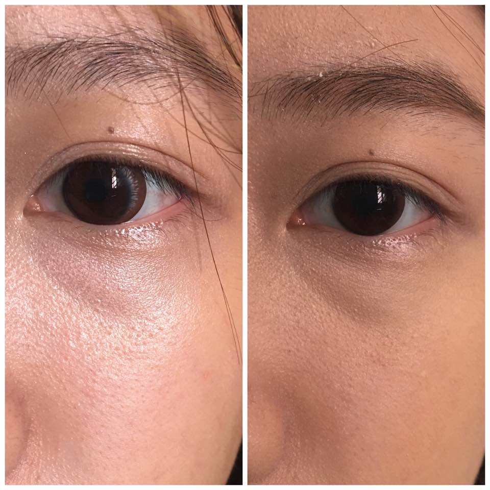 Review: Becca Under Eye Brightening Corrector - Hermioneginny - Dayre